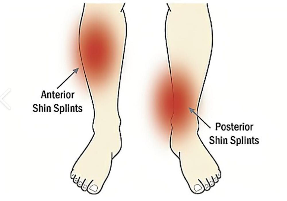 Οι κυριότεροι τραυματισμοί στον μαραθώνιο - Τι πρέπει να προσέξετε runbeat.gr